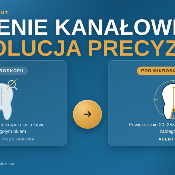 Leczenie kanałowe w Warszawie – przewodnik ekspercki (2026)