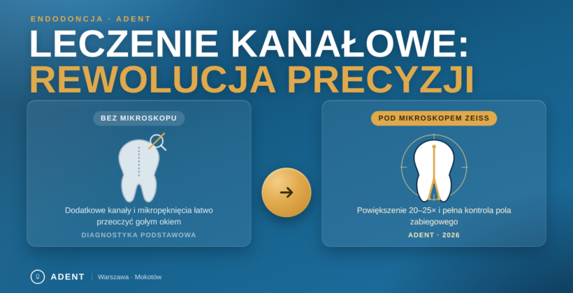 Leczenie kanałowe w Warszawie – przewodnik ekspercki (2026)