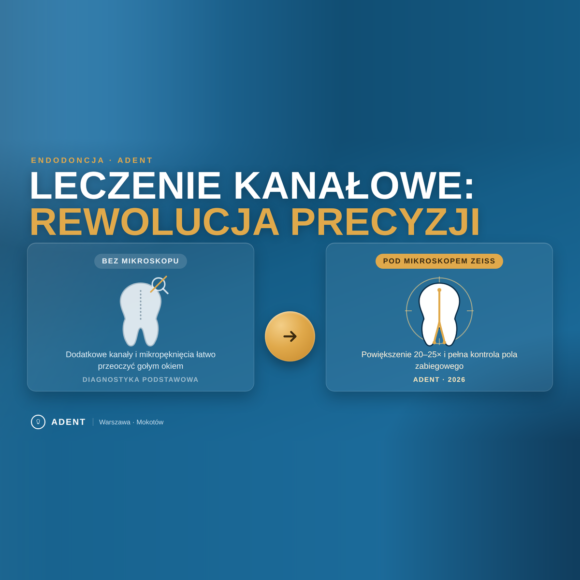 Leczenie kanałowe w Warszawie – przewodnik ekspercki (2026)